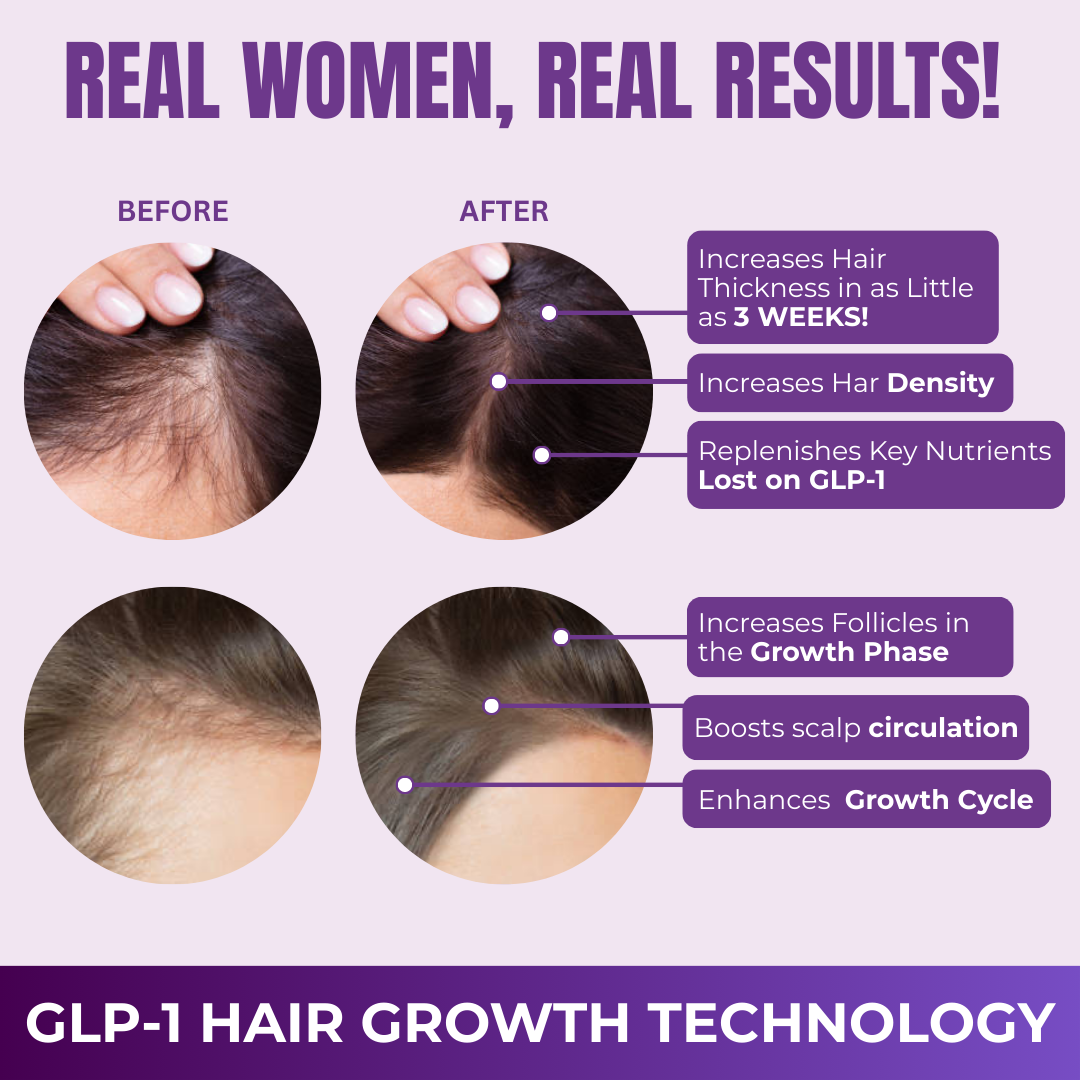 Hair Growth Accelerator Soft Chews